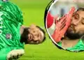 A foto assustadora de Donnarumma com pontos no rosto após pisão; rival se desculpa - Foto: @ ESPN - Todos os direitos: @ ESPN