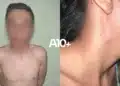 abuso sexual, violação, agressão sexual;