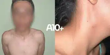 abuso sexual, violação, agressão sexual;